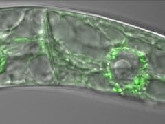 Zeleně světélkující bílkovina PIN5 v buňkách rostliny tabáku.