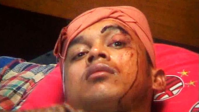 Zraněný muž v Padangu. Obětí mohou být tisíce, řekl ve čtvrtek ministr zdravotnictví