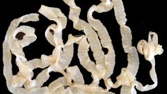 Tasemnice Skulovec Lipno