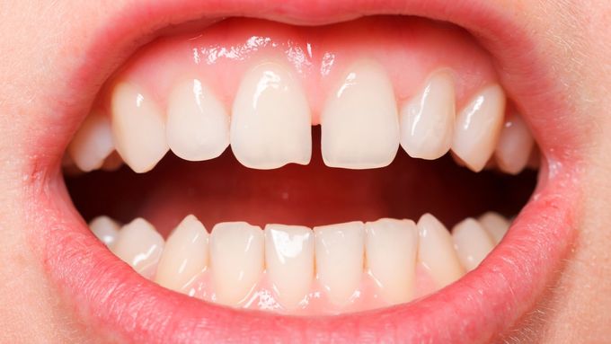 Ilustrační snímek