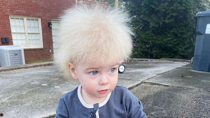 Na divokou kštici jednoročního chlapce z americké Georgie jsou všechny hřebeny krátké. U blonďáčka s modrýma očima se totiž objevil vzácný syndrom neučesatelných vlasů.