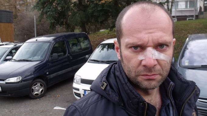 Náměstek Pavel Beran po rvačce s vojenským policistou.