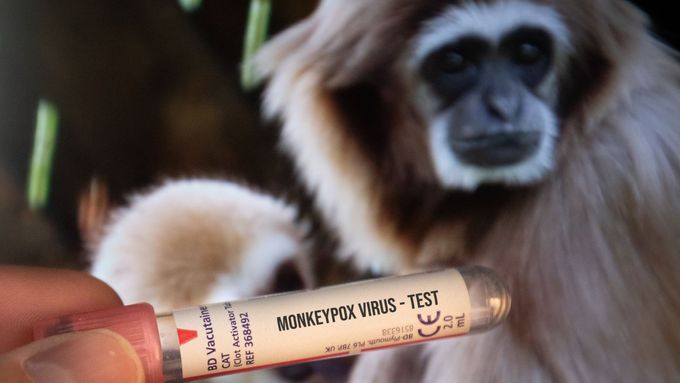 Opičí neštovice (ilustrační foto)