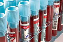 HIV pozitivní Čech dostal jako první v Evropě nový lék, od výrobce jej obdržel darem