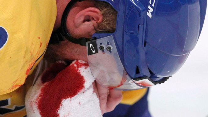 Zkrvavený Franzén v utkání Rusko - Švédsko