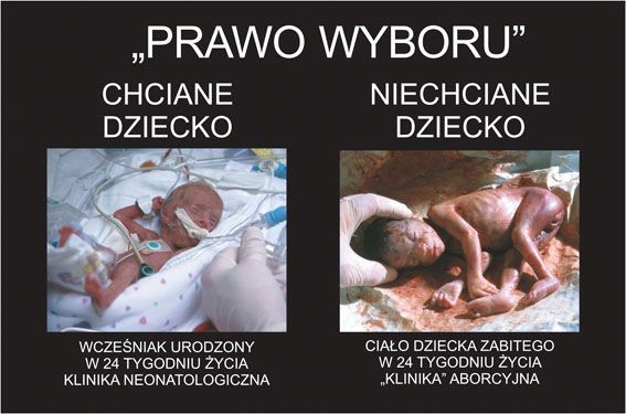 Snímek z výstavy Vyber život: "Právo výběru: "Chtěné dítě - předčasně narozené dítě ve 24 týdnu těhotenství, neonatologická klinika. Nechtěné dítě - tělo dítěte zabitého ve 24 týdnu života, potratová klinika" | Foto: nieaborcji.pl