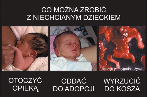 Snímek z výstavy Vyber život: "Co lze udělat s nechtěným dítětem: Zahrnout ho péčí, dát ho k adopci, vyhodit do koše" | Foto: nieaborcji.pl