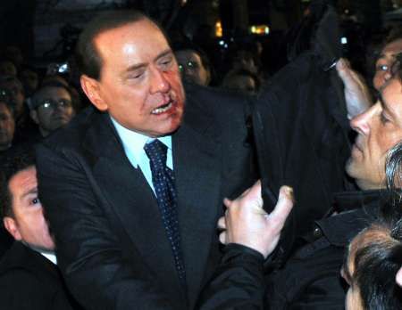 Italský premiér Silvio Berlusconi v polovině prosince 2009 opustil se zkrvavenou tváří mítink své strany na náměstí před dómem v Miláně poté, co po něm jeden muž hodil suvenýr v podobě slavného milánského chrámu. | Foto: Reuters