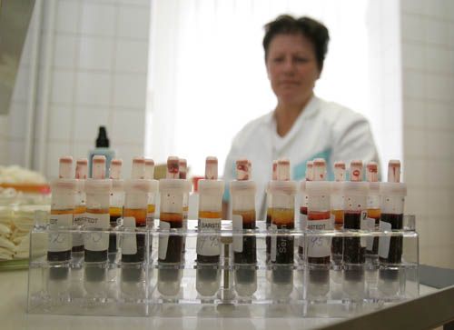 Laboratoř pražského Domu světla, kde pomáhají HIV pozitivním. | Foto: Ondřej Besperát