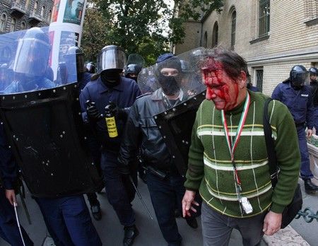 Zraněný demonstrant | Foto: Reuters