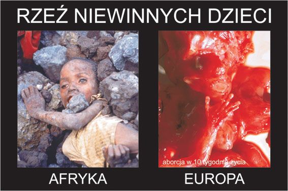 Snímek z výstavý Vyber život: "Masakr nevinných dětí - Afrika, Evropa" | Foto: nieaborcji.pl