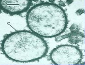 Bakterie rodu Mycoplasma. Takové Craig Venter přetvářel podle svých představ. | Foto: Universität Leipzig