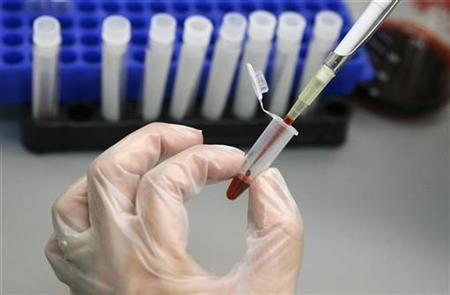 Testování vzorku HIV/AIDS | Foto: Reuters