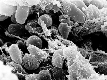 Mikroskopická zvětšenina bakterie Yersinia pestis - je původcem pravého moru. | Foto: Reuters