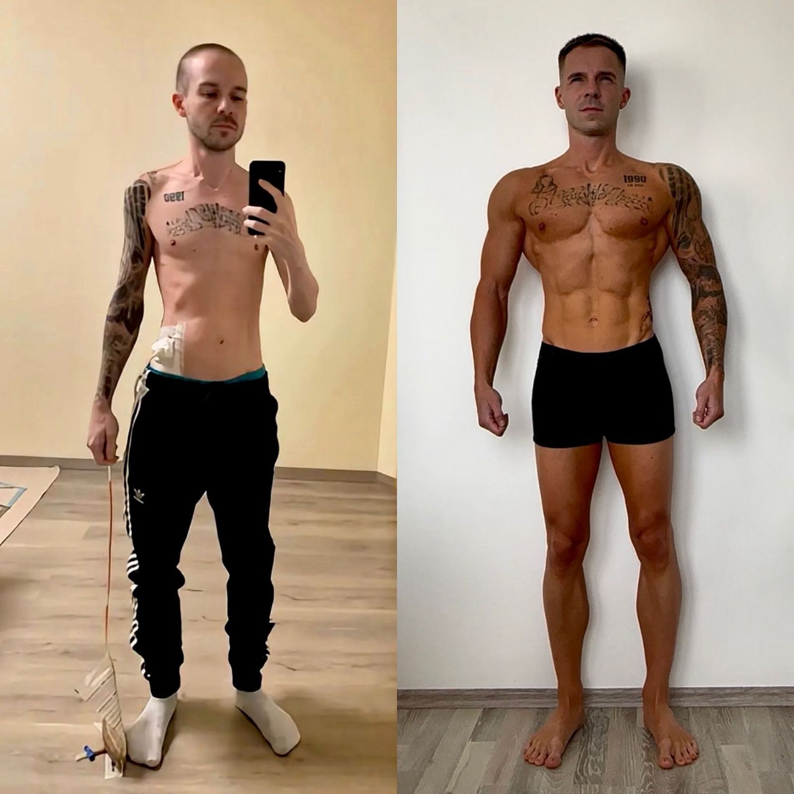 "Infekce mě rozežírala zaživa." Čech přežil horor, vážil 42 kg, teď je mistrem světa