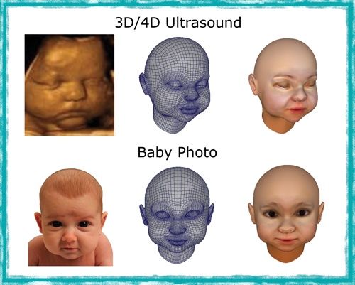 Foto: 3d-babies.com