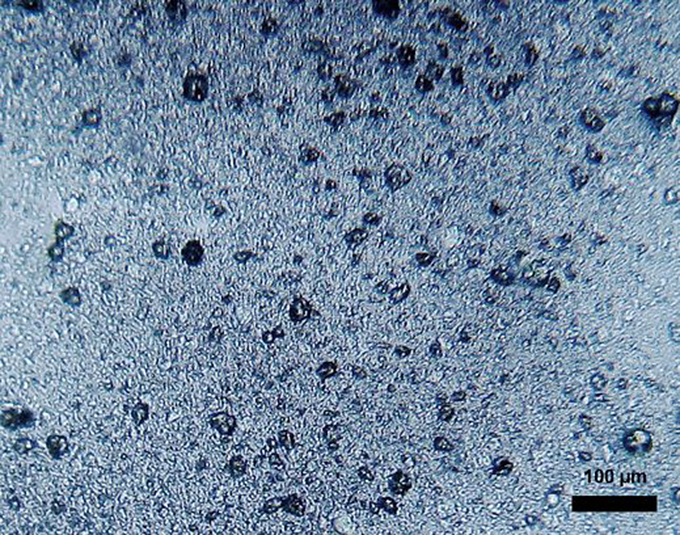 Mikroplasty je obecné označení, užívané pro různorodé úlomky plastů o velikosti od 100 nanometrů až po 5 milimetrů, které se vyskytují ve vodě, v půdě i ve vzduchu. | Foto: Dantor (talk) / Wikipedia / Creative Commons Attribution-Share Alike 3.0 Unported license.