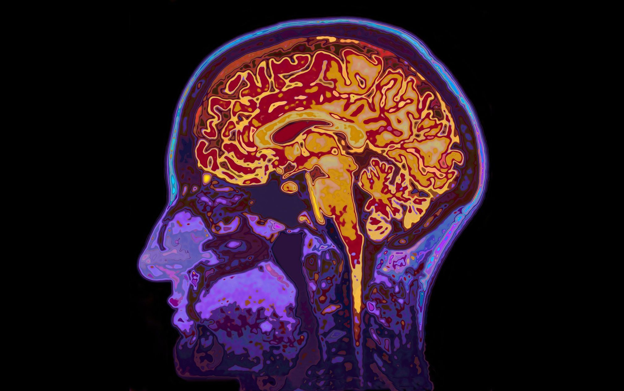 Quiz: Cerebellum, hypothalamus or temporal lobe.  Recognize the individual parts of the brain from the picture