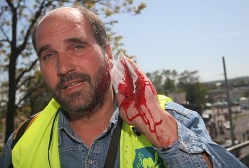 Reportéra Lubomíra Kotka zranila policie výbuškou, které během zásahu nešetrně házela mezi demonstranty. | Foto: Tomáš Adamec