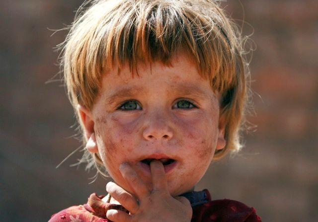 Tříletý Gulruch nalezl útočiště v uprchlickém táboře Úřadu vysokého komisaře OSN pro uprchlíky (UNHCR) v Péšáváru | Foto: Reuters