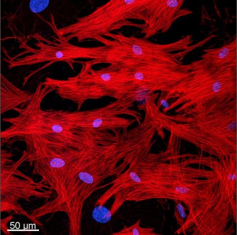 Srdeční svalstvo pod fluorescenčním mikroskopem - červeně jsou znázorněny myofibrily (základní jednotka svalového vlákna), modře jádra buněk | Foto: MPI for Heart and Lung Research