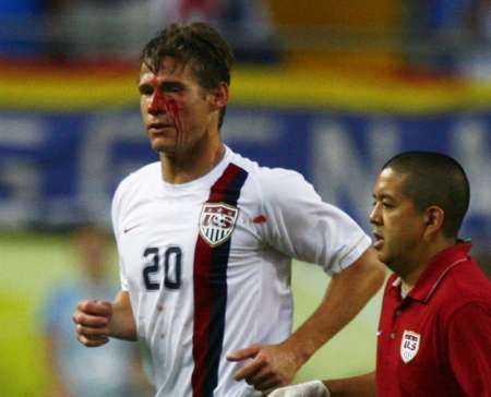 Americký útočník Brian McBride zraněný při utkání s Itálií. | Foto: Reuters