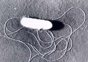 Baktérie Listeria monocytogenes v elektronovém mikroskopu. | Foto: Wikimedia Commons