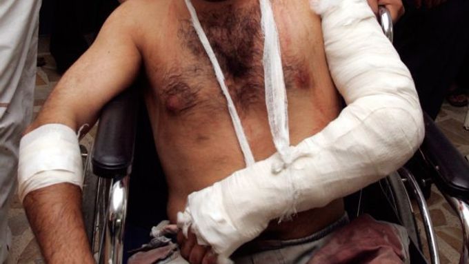 Muž, který byl zraněn při atentátu na tržišti v Mahmúdíja jižně od Bagdádu.