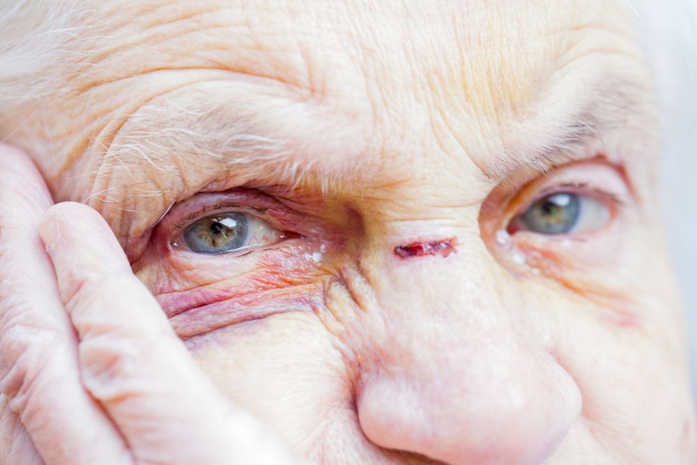 Domácí násilí na seniorech - týrání seniorů