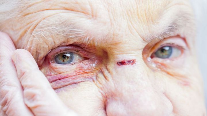 Týrají je vlastní děti, senioři jsou zoufalí. Přemozte strach a nemlčte, radí expert