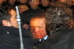 Berlusconimu po ráně zašili ret, útočník je ve vazbě