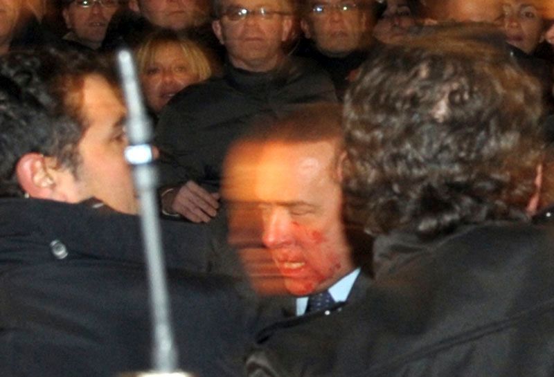 Zraněný Silvio Berlusconi