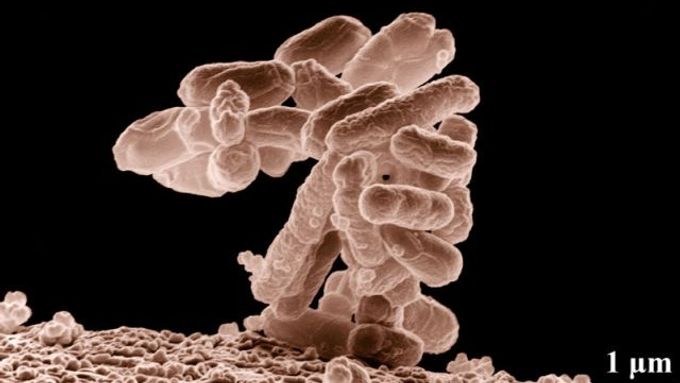 Kolonie Escherichia coli - zvětšená 10 000 krát.