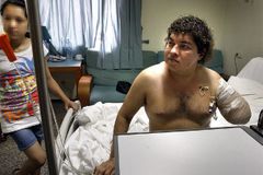 Šéf vyhodil uřízlou ruku zaměstnance do smetí