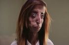 VIDEO "Nejošklivější" žena světa začala bojovat proti šikaně