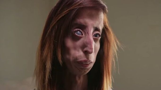 Lizzie Velasquez