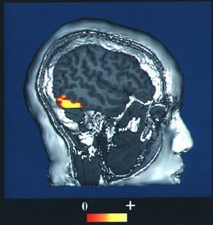 fMRI mozku