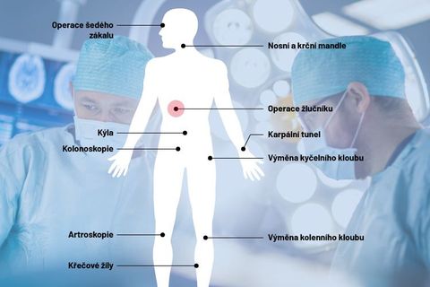 Na nové koleno se čeká i 2,5 roku. Porovnali jsme, jak dlouhé jsou fronty na operace