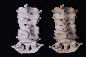 Lidské orgány ve 3D. Unikátní modely pro všechny, kteří chtějí lépe poznat anatomii