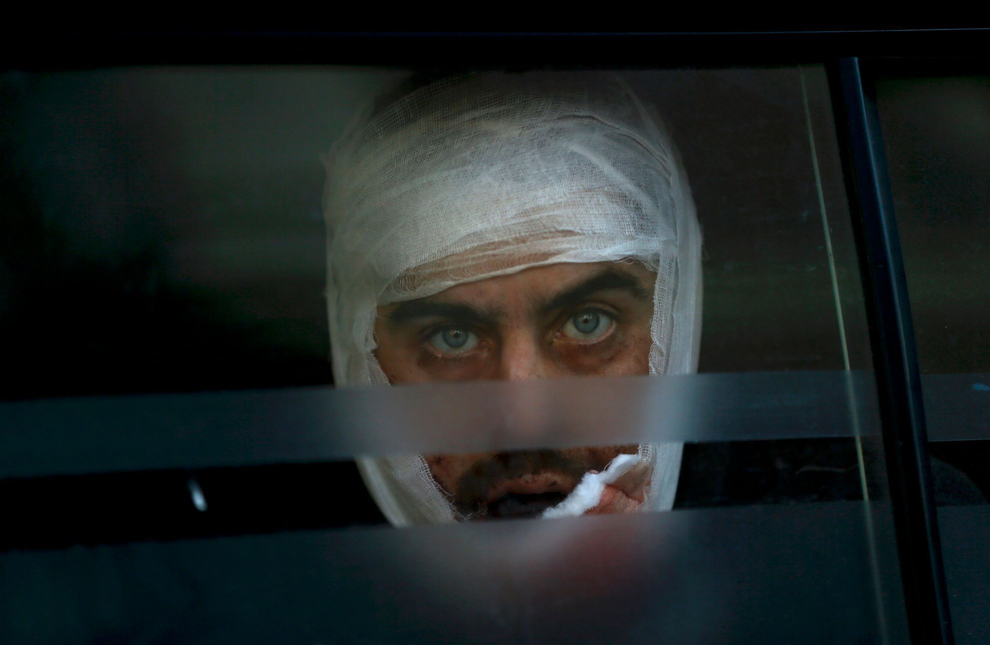 A wounded Ukrainian soldier looks through a windows as he arrives to a hospital in Artemivsk