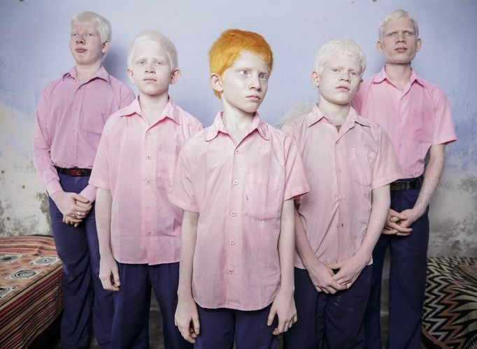 Brent Stirton, a South African photographer working for Reportage by Getty Images won the 1st Prize People - Staged Portraits Single category of the 2014 World Press Photo contest with this picture of a group of blind albino boys in their boarding room at the Vivekananda mission school for the blind in West Bengal, taken September 25, 2013.