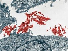 Viry prasečí chřipky H1N1 (červeně) pod mikroskopem.