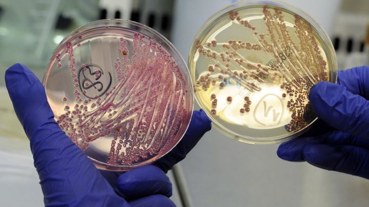 Umělá inteligence našla nové antibiotikum. Jedno z nejúčinnějších, hlásí vědci