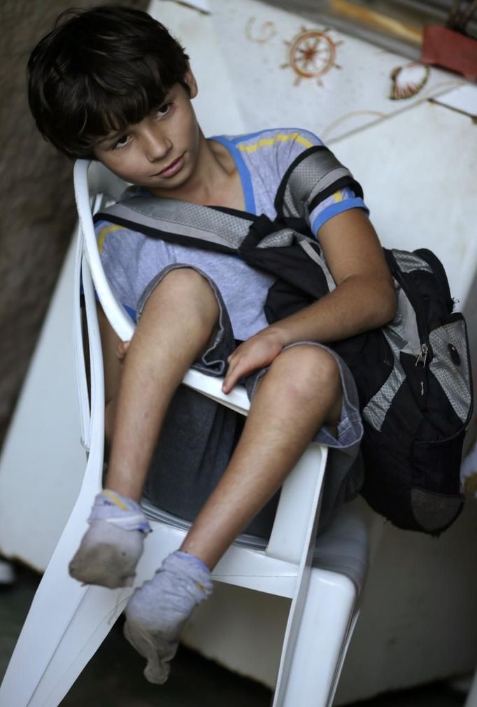 Gabriel Muniz, 11, sits in a chair at home in Campos dos Goytacazes, 274 kilometres (170 miles) northeast of Rio de Janeiro August 22, 2012. Despite being born with malformation of his feet, fourth grader Gabriel puts in hours into soccer everyday in his neighbourhood. He aspires to be a professional soccer player just like his idol Argentina's Lionel Messi of Barcelona FC. REUTERS/Ricardo Moraes (BRAZIL - Tags: SPORT SOCCER SOCIETY HEALTH) Published: Srp. 24, 2012, 2:26 dop.