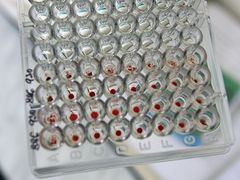 Protilátky ukazují, který vzorek obsahuje chřipkový virus.