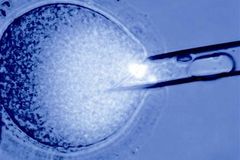 Z části lidské a z části prasečí embryo. Američtí vědci "vypěstovali" chiméru v těle prasnice