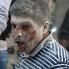 Aleppo, Sýrie