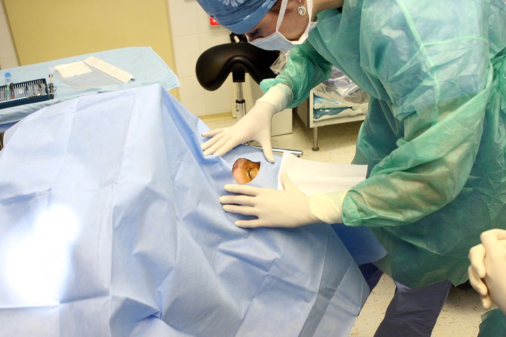 Laserová operace šedého zákalu