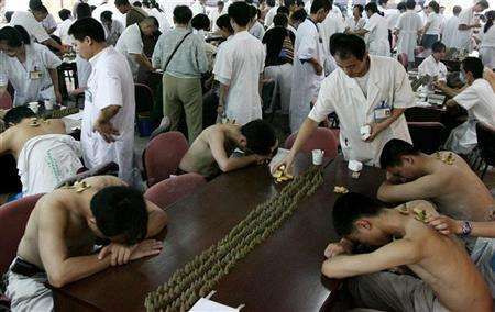 Tradiční akupunkturní léčba v nemocnici v Ćíně.