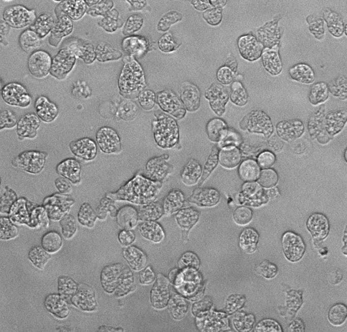 Naegleria fowleri napadá lidský mozek a přes veškerou moderní léčbu 97 % případů končí fatálně. Na mikroskopickém snímku: Naegleria fowleri v kultuře